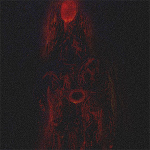 « The Belvedere Torso » • Carte blanche #6 • Sarvshrest Singh